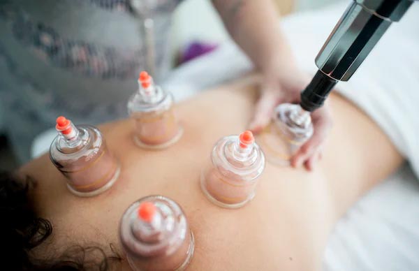 Cupping Massage uses suction cups to balance the body's Yin and Yang, increasing blood flow, easing muscle tension, and promoting cell repair.